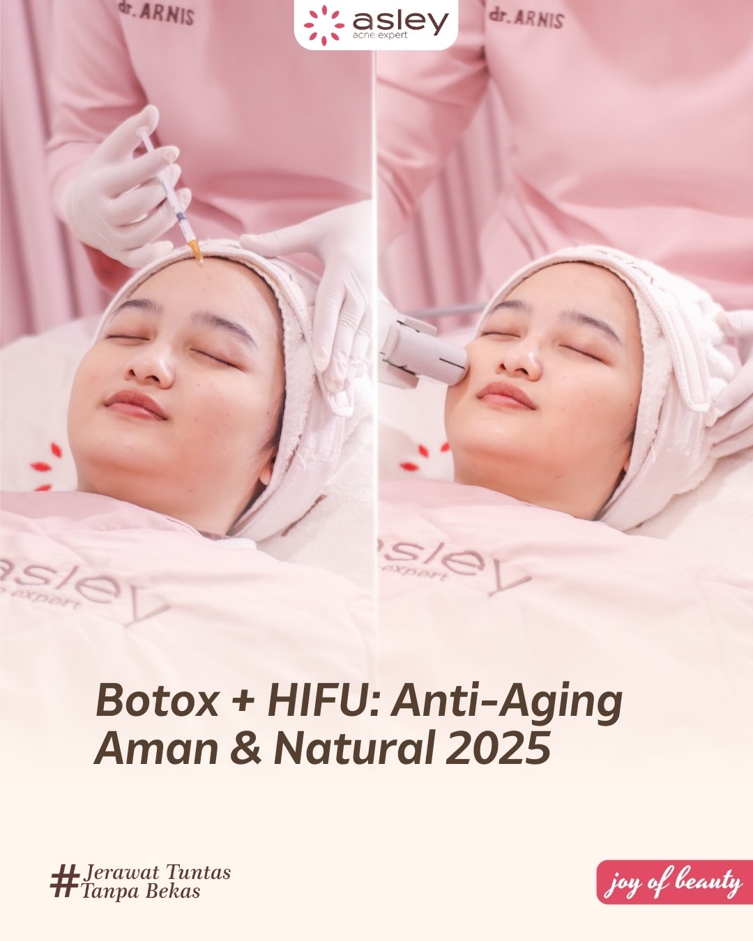 Botox Anti-Aging: Cara Efektif Menghilangkan Kerutan & Memudakan Wajah Secara Alami